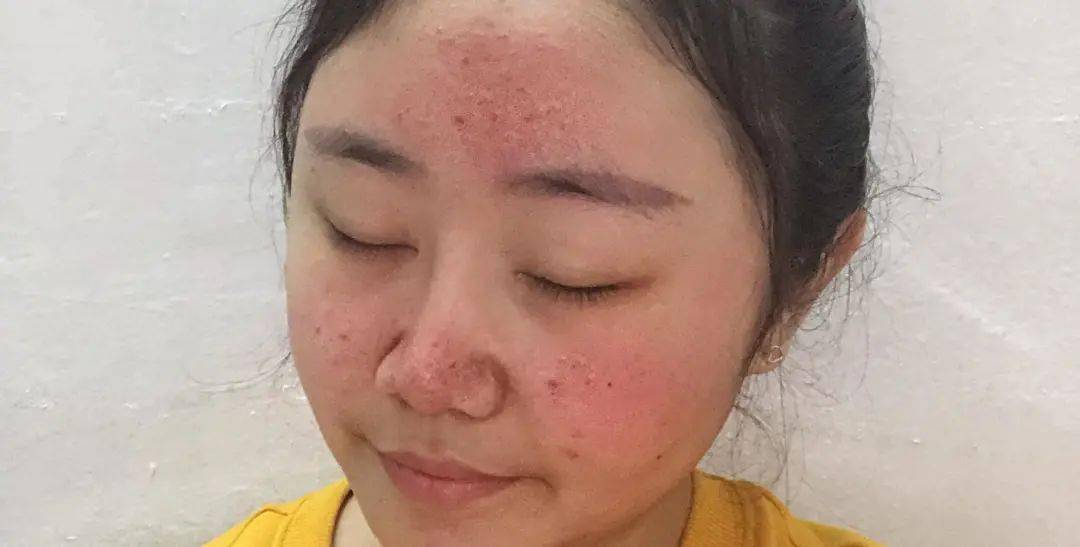 坚持每天用化妆品化妆品，几年后皮肤会差很多吗？化妆品不背这锅