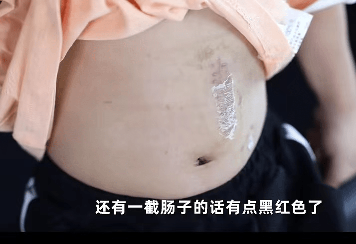 磁力珠成“致命杀手”儿童玩具品牌，男孩三天两次手术，避雷这几款儿童玩具